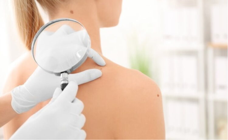 How Long for Mohs Surgery to Heal After the Procedure